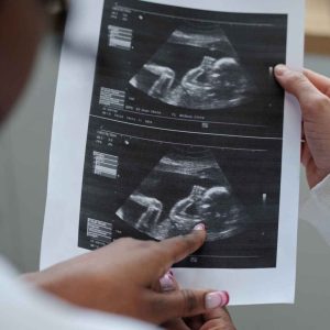menanti anak coming soon